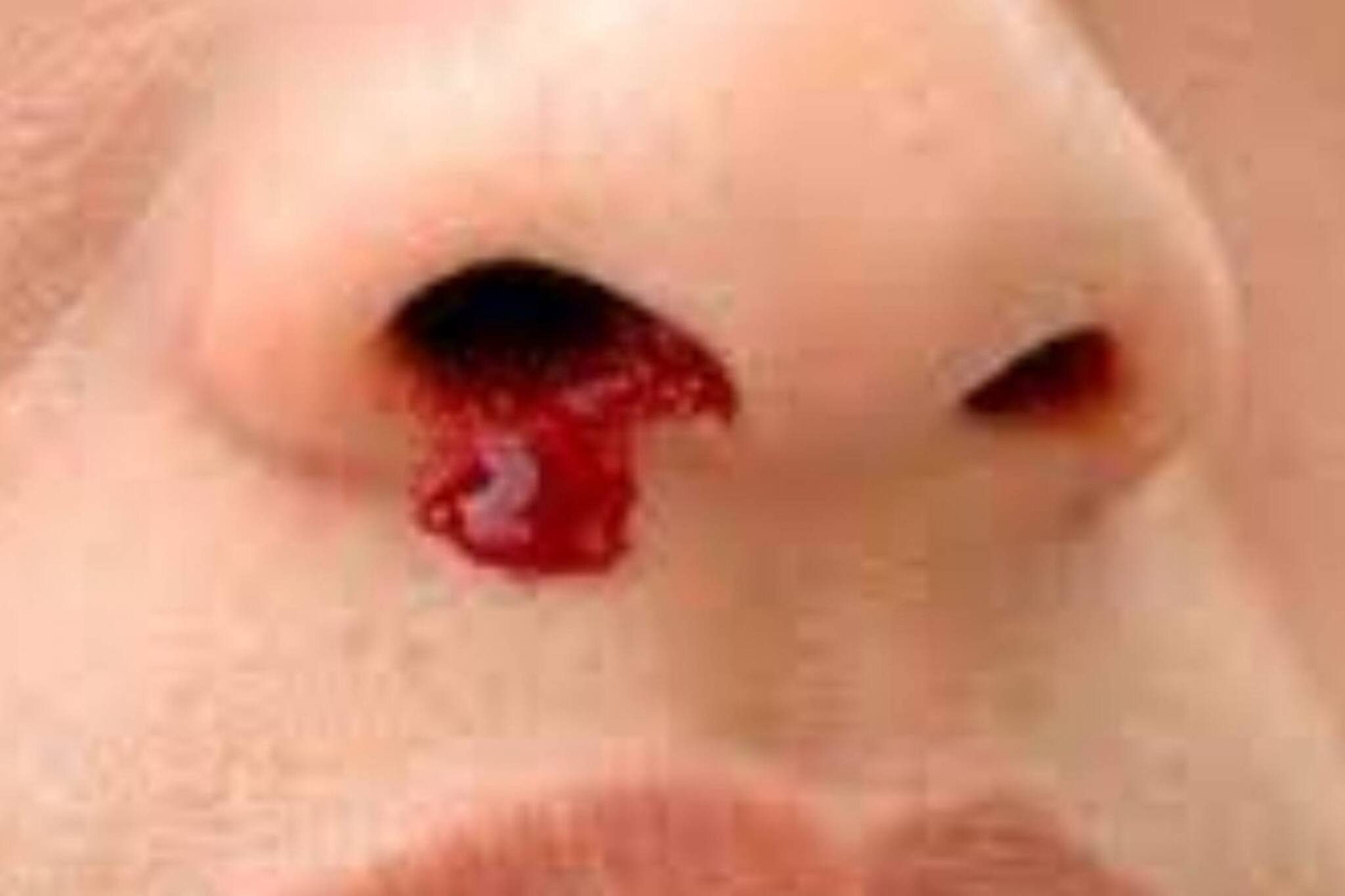 গরম বাড়তেই নাক দিয়ে গড়াচ্ছে রক্ত? রইল এই সমস্যা প্রতিরোধের কিছু উপায়!