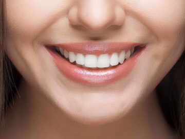 Teeth Whitening
