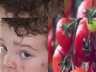 Tomato Flu