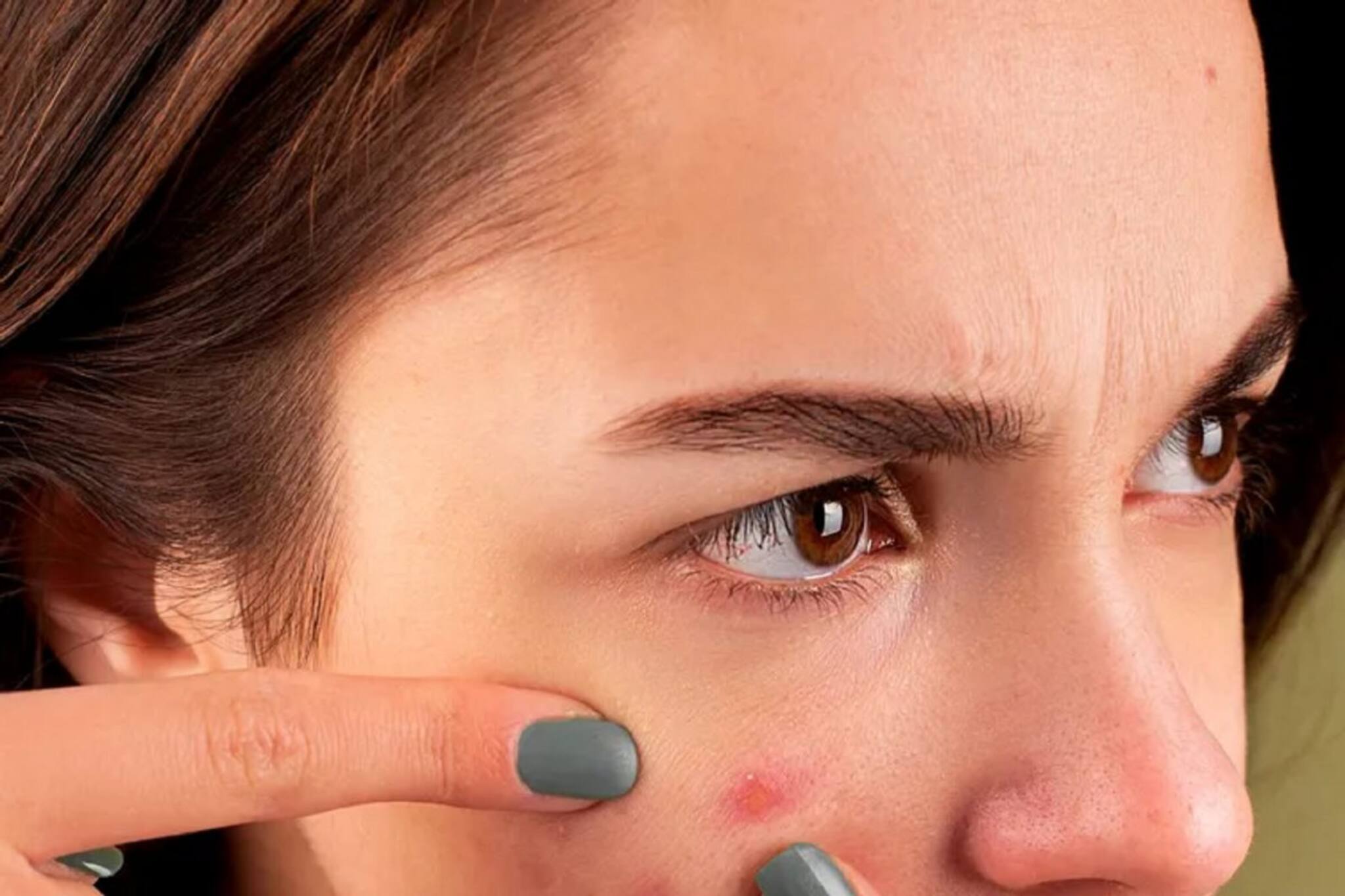 একবার খেয়ে দেখুন এই খাবারটি, ব্রণর সমস্যা কিন্তু কমতে বাধ্য