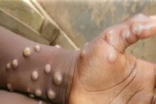 নয়া আতঙ্ক 'Monkeypox', আগাম তৎপরতা রাজ্য স্বাস্থ্য দফতরে! নির্দেশিকা জারি নয়া আতঙ্ক 'Monkeypox', আগাম তৎপরতা রাজ্য স্বাস্থ্য দফতরে! নির্দেশিকা জারি