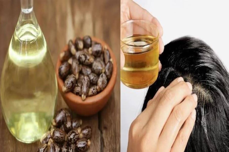 Castor oil has many benefits in knee pain and haircare arcহাঁটুর