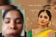 দাঁতের চিকিৎসা করাতে গিয়ে মুখ ফুলে বীভৎস রূপ অভিনেত্রীর! জানুন বিপত্তির কারণ দাঁতের চিকিৎসা করাতে গিয়ে মুখ ফুলে বীভৎস রূপ অভিনেত্রীর! জানুন বিপত্তির কারণ