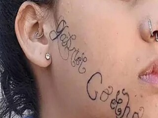 ব্রেক-আপের বদলা, তরুণীর মুখে নিজের নিজের নাম খোদাই করলেন প্রাক্তন!