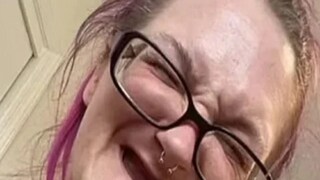 ৩১ বছরেই সব দাঁত খুইয়ে অশীতিপর অ্যাশলে, সোশ্যাল মিডিয়ায় হইচই!