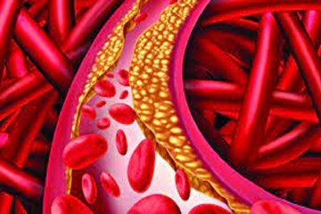 Bad Cholesterol শরীর থেকে দূর করে জীবনকে সুস্থ, ফুরফুরে ও চনমনে করে Bad Cholesterol শরীর থেকে দূর করে জীবনকে সুস্থ, ফুরফুরে ও চনমনে করে