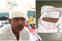 কামড় দিয়ে দাদার কান ছিঁড়ে দিল ভাই, কেন? কামড় দিয়ে দাদার কান ছিঁড়ে দিল ভাই, কেন?
