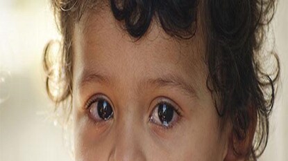 Health Tips Health Tips