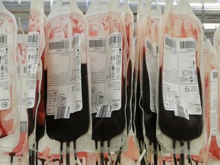 EMM Negative Blood Group