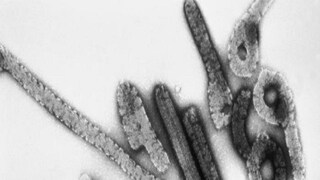 মারবার্গ ভাইরাসের হানা