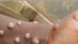 পরিস্থিতি নিয়ন্ত্রণে রাখতে রবিবার উচ্চপর্যায়ের বৈঠক ডাকা হয় কেন্দ্রের তরফে পরিস্থিতি নিয়ন্ত্রণে রাখতে রবিবার উচ্চপর্যায়ের বৈঠক ডাকা হয় কেন্দ্রের তরফে