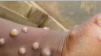 পরিস্থিতি নিয়ন্ত্রণে রাখতে রবিবার উচ্চপর্যায়ের বৈঠক ডাকা হয় কেন্দ্রের তরফে পরিস্থিতি নিয়ন্ত্রণে রাখতে রবিবার উচ্চপর্যায়ের বৈঠক ডাকা হয় কেন্দ্রের তরফে