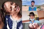 ৯০ ডিগ্রি বাঁকা ঘাড়, নিখরচায় পাকিস্তানি কিশোরীকে নতুন জীবন ভারতের চিকিৎসকের