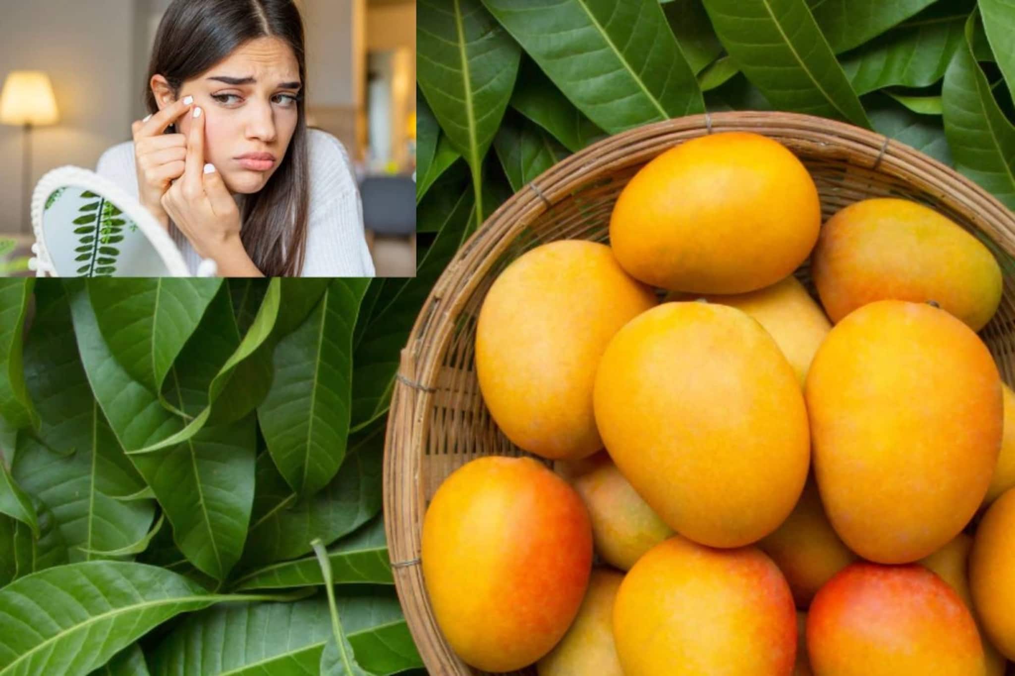 আম খেলে ব্রণ ও অ্যাকনে হয়? জানুন আসল কথা