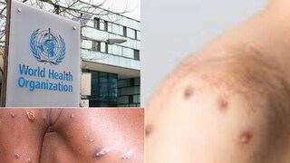 ইউরোপ, উত্তর আমেরিকা-সহ অন্যান্য অংশে এই অসুখ অতিমারির পর্যায়ে পৌঁছেছে