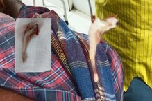 হঠাৎ নাকের ফুটোয় আটকে গেল জ্যান্ত চিংড়ি মাছ! দমবন্ধ, হাঁসফাঁস! কী হল তারপর? হঠাৎ নাকের ফুটোয় আটকে গেল জ্যান্ত চিংড়ি মাছ! দমবন্ধ, হাঁসফাঁস! কী হল তারপর?