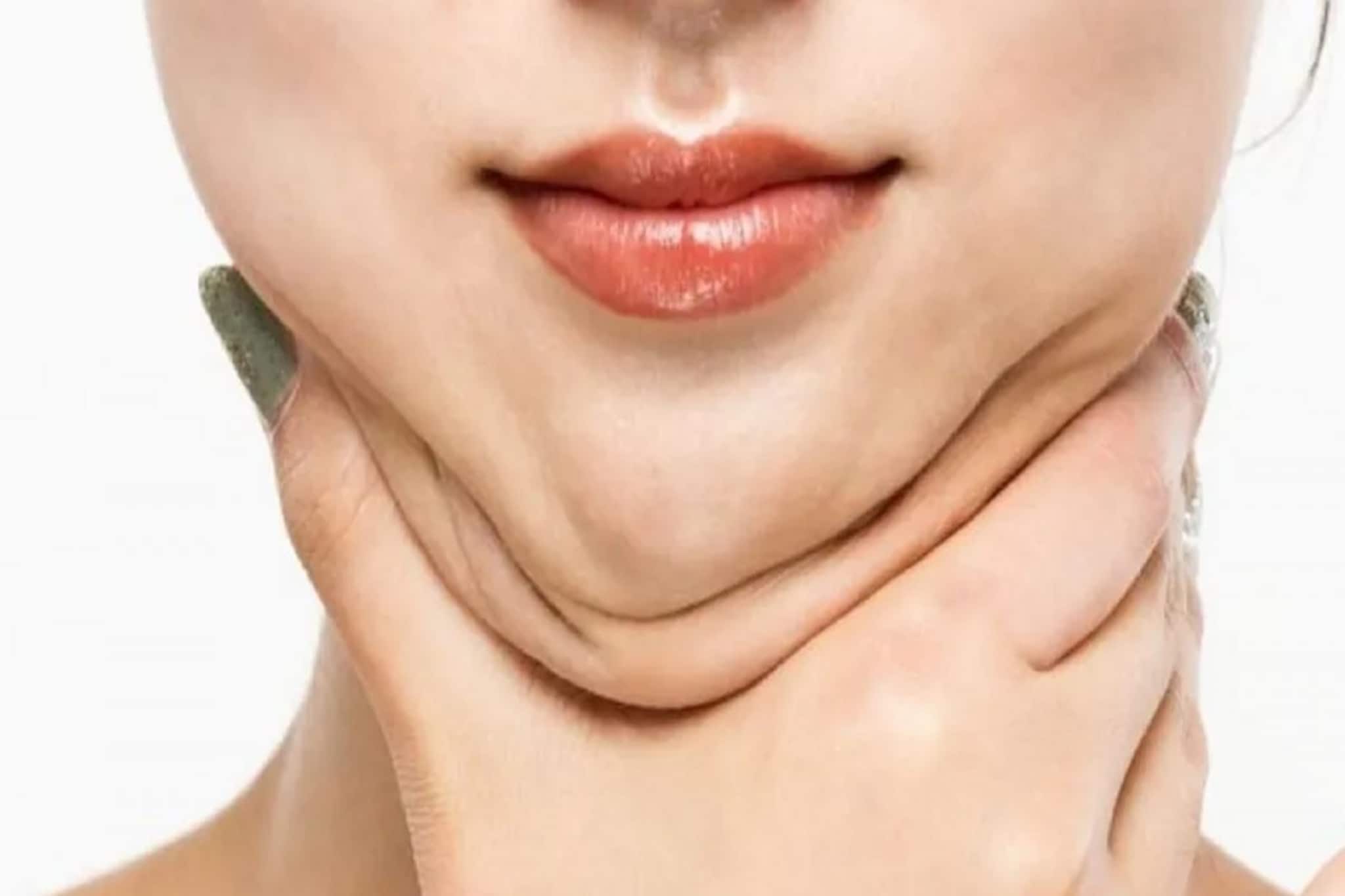 ডাবল চিনের সমস্যা ? মুখের এই ব্যয়ামেই ফিরবে সৌন্দর্য