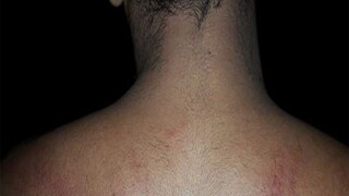 প্রতীকী ছবি প্রতীকী ছবি