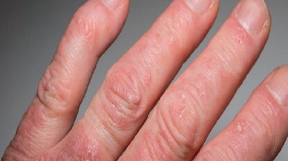 প্রতীকী ছবি ৷ প্রতীকী ছবি ৷