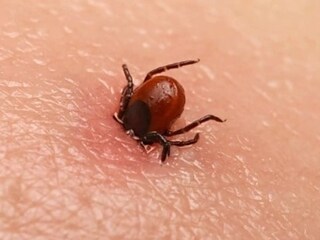 Scrub Typhus
