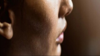  humidity can damage your skin equilibrium, know remedies 