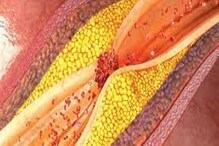 Bad Cholesterol-এর চরম শত্রু এই সব্জি! Blood Sugar Level নিয়ন্ত্রণে ব্যাপক কাজ Bad Cholesterol-এর চরম শত্রু এই সব্জি! Blood Sugar Level নিয়ন্ত্রণে ব্যাপক কাজ