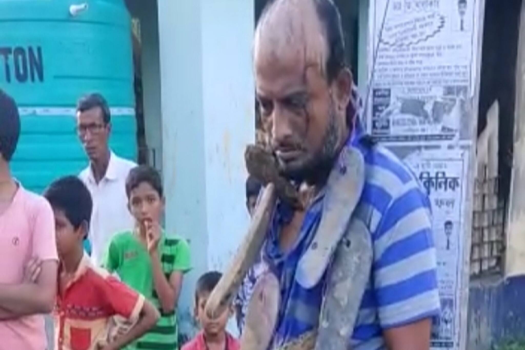 East Bardhaman News: পরকীয়ার প্রতিশোধ, হাতুড়ে ডাক্তারকে ন্যাড়া করে খুঁটিতে বেঁধে বেধড়ক মার!