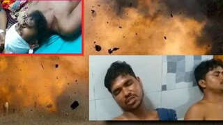 আহত অবস্থায় পাঁচজন চিকিৎসাধীন বহরমপুরে মুর্শিদাবাদ মেডিক্যাল কলেজ হাসপাতালে 