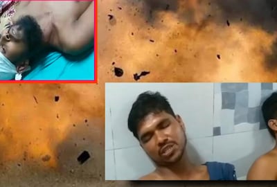 আহত অবস্থায় পাঁচজন চিকিৎসাধীন বহরমপুরে মুর্শিদাবাদ মেডিক্যাল কলেজ হাসপাতালে 