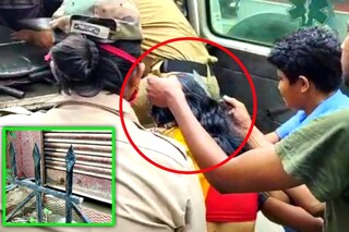 বৃদ্ধার মাথায় ঢুকে রয়েছে লোহার গ্রীল 