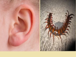 Alive centiped recovered from patient's ear