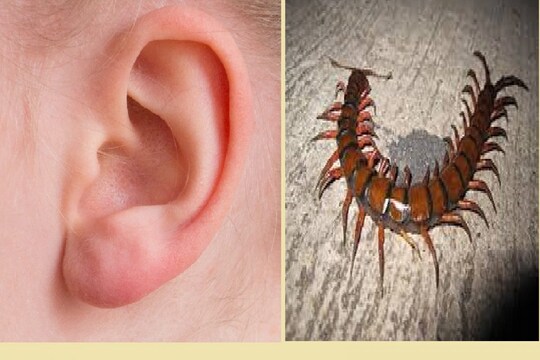 Alive centiped recovered from patient's ear