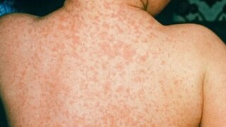 সংগৃহীত ছবি। সংগৃহীত ছবি।