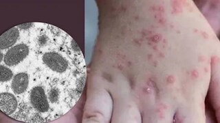 বাচ্চাদের নিয়ে চিন্তাটা বেশি