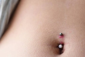 নাভিমূলে ফোলাভাব ও ক্ষরণ হলে সংক্রমণের আশঙ্কা, রইল উপশমের ঘরোয়া টোটকা নাভিমূলে ফোলাভাব ও ক্ষরণ হলে সংক্রমণের আশঙ্কা, রইল উপশমের ঘরোয়া টোটকা