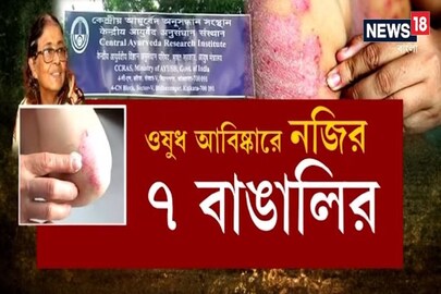 সোরিয়াসিসের ওষুধ