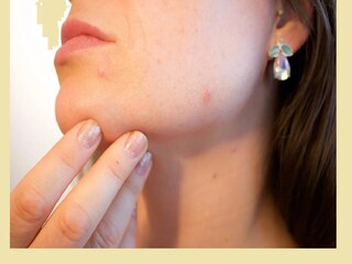 Skin Care: not all the skin infections are eczema everything you need to know