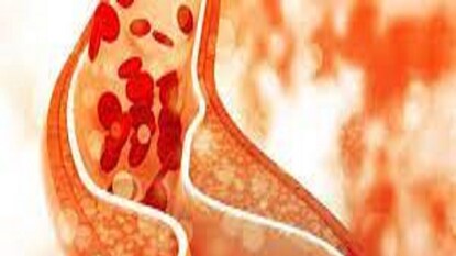 প্রতীকী ছবি ৷ প্রতীকী ছবি ৷