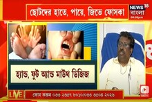 করোনা-ডেঙ্গির মাঝে নতুন আতঙ্ক হ্যান্ড-ফুট অ্যান্ড মাউথ ডিজিজ