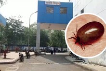 স্ক্রাব টাইফাস সংক্রমণে বাড়ছে মৃত্যু, কীভাবে বুঝবেন আপনি আক্রান্ত কিনা, জানুন