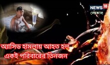 ঘুমন্ত অবস্থায় অ্যাসিড হামলা, গুরুতর আক্রান্ত বাবা মা ও সন্তান ঘুমন্ত অবস্থায় অ্যাসিড হামলা, গুরুতর আক্রান্ত বাবা মা ও সন্তান