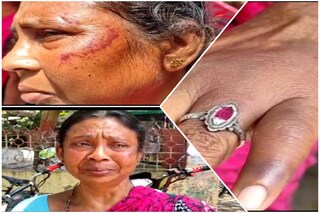 থানাতে হাজির আহত শাশুড়ি পুতুল দাস