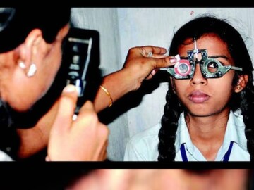 চিকিৎসকদের মতে নানা কারণে শৈশবে ছানি পড়তে পারে