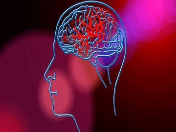 Brain Stroke: signs of a brain stroke and things one should do in this case -Photo- Representative 