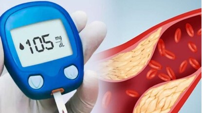 ডায়াবেটিস-কোলেস্টেরলের যম! অতি পরিচিত এই গাছের উপরই ভরসা করেন আয়ুর্বেদিক চিকিৎসকরা ডায়াবেটিস-কোলেস্টেরলের যম! অতি পরিচিত এই গাছের উপরই ভরসা করেন আয়ুর্বেদিক চিকিৎসকরা