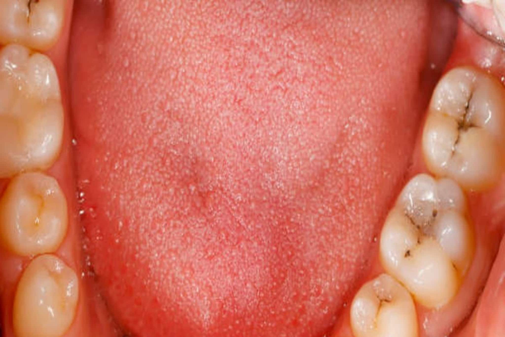 দেদার মদ-তামাক? সাবধান! মুখে এমন দাগ পড়ছে না তো? আয়নার সামনে দাঁড়িয়ে দেখুন...