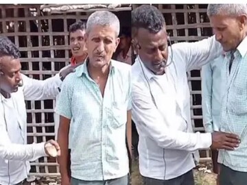 অভিনব উপায়ে গ্যাসের সমস্যা সারিয়ে তোলেন এই ‘ডাক্তার’! ভাইরাল ভিডিও দেখে তাজ্জব নেটদুনিয়া