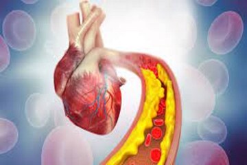 High Cholesterol-এর সমস্যা থেকে মুক্তি দিতে পারে এই পাঁচ ডাল, ওজনও থাকবে কাবু High Cholesterol-এর সমস্যা থেকে মুক্তি দিতে পারে এই পাঁচ ডাল, ওজনও থাকবে কাবু