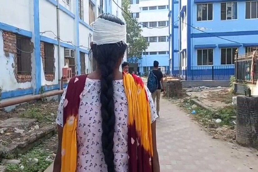 মালদা মেডিকেল কলেজ হাসপাতালে চিকিৎসাধীন অবস্থায় তিনি বলেন , ভালোবাসা করে বিয়ে করেছিলাম । গত কয়েক বছরে একাধিক বিয়ে করেছেন স্বামী । বিবাহ বর্হিভূত সম্পর্ক জানতে পেরে হাতেনাতে ধরতে যায় । সেই সময় আমার ওপরে ইট ও ধারালো অস্ত্র নিয়ে হামলা চালানো হয় ।  পুরাতন মালদা থানায় অভিযোগ জানিয়েছি , আশা করি সুবিচার পাবো । স্বামীর দৃষ্ঠান্ত মূলক শাস্তির দাবি করেন তিনি। Input-Sebak DebSarma