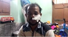 ধারালো অস্ত্রের কোপ! সারা শরীর রক্তাক্ত ব্যবসায়ীর! লক্ষাধিক টাকা গায়েব! ভয়াবহ ধারালো অস্ত্রের কোপ! সারা শরীর রক্তাক্ত ব্যবসায়ীর! লক্ষাধিক টাকা গায়েব! ভয়াবহ